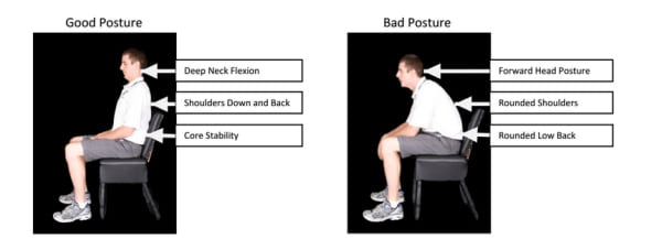 Chiropractic Oak Ridge TN Posture